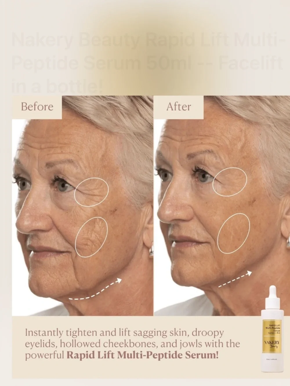 Nakery Beauty experience tightening