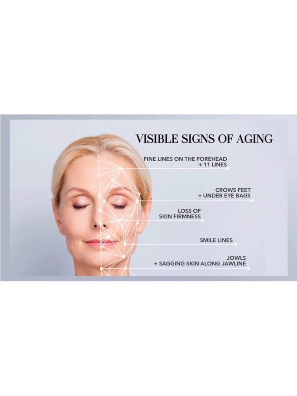 Nakery Beauty experience tightening