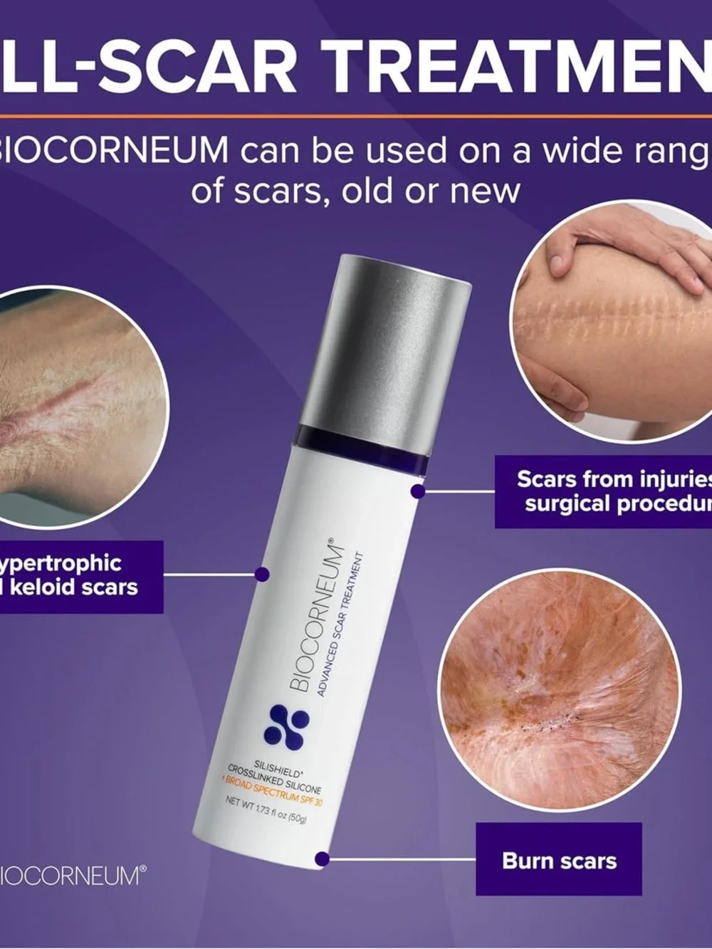 Biocorneum biocorneum® silishield®