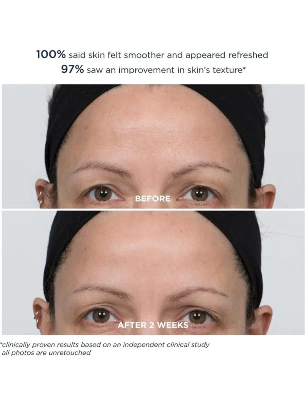 Extra Strength 20% PowerGlow Peel | Intense Overnight Resurfacing Treatment