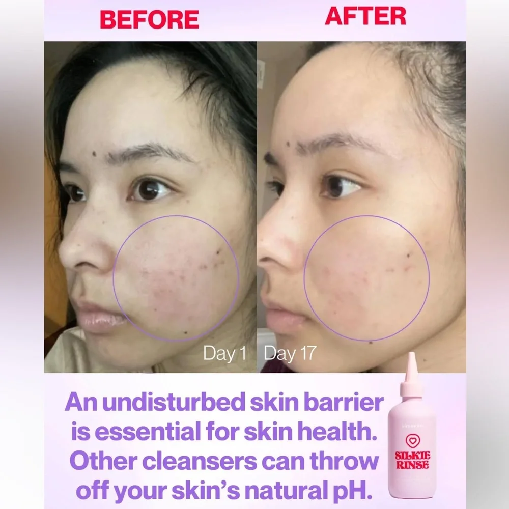 kiramoon hydrate rinse skin
