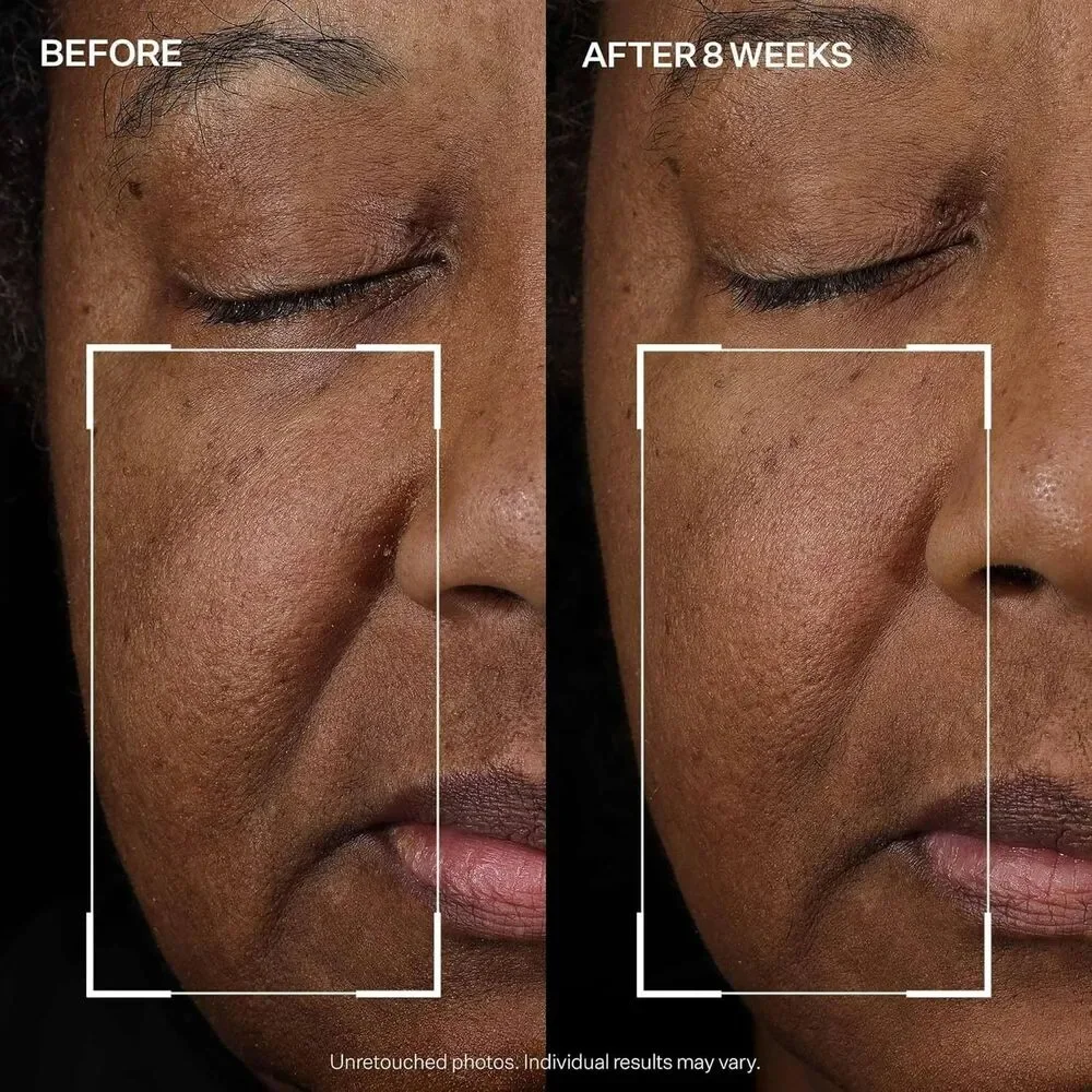 StriVectin welcome vermax