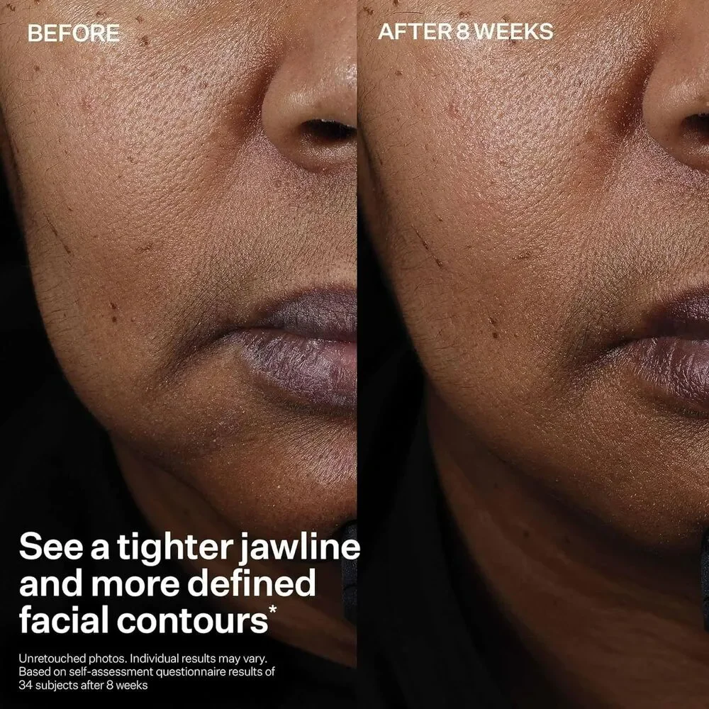 StriVectin welcome vermax